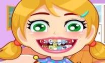 Aparelhos nos Dentes