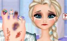Elsa Foot Injured