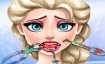 Lesão no Dente de Elsa